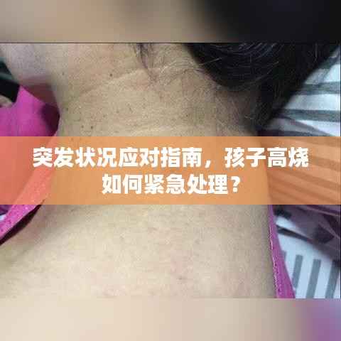 突发状况应对指南，孩子高烧如何紧急处理？